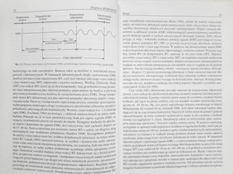 Time structure of information processes in selected combat sports